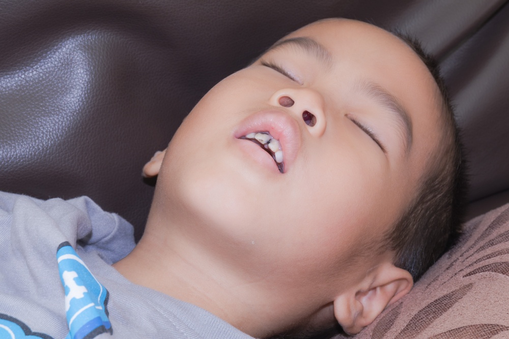 Sleep Apnea in Children Signs and Symptoms